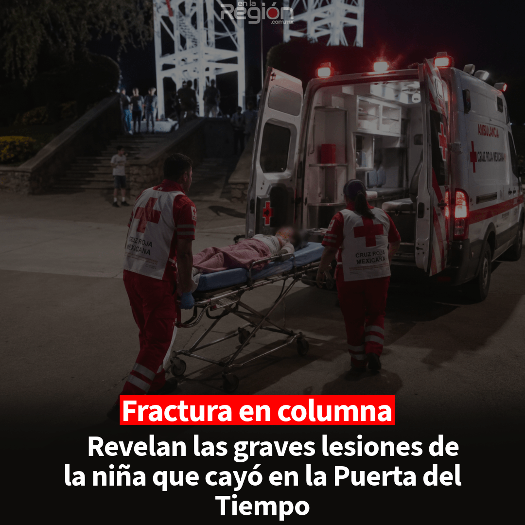Dan a conocer las lesiones de la pequeñita accidentada en la Puerta del Tiempo